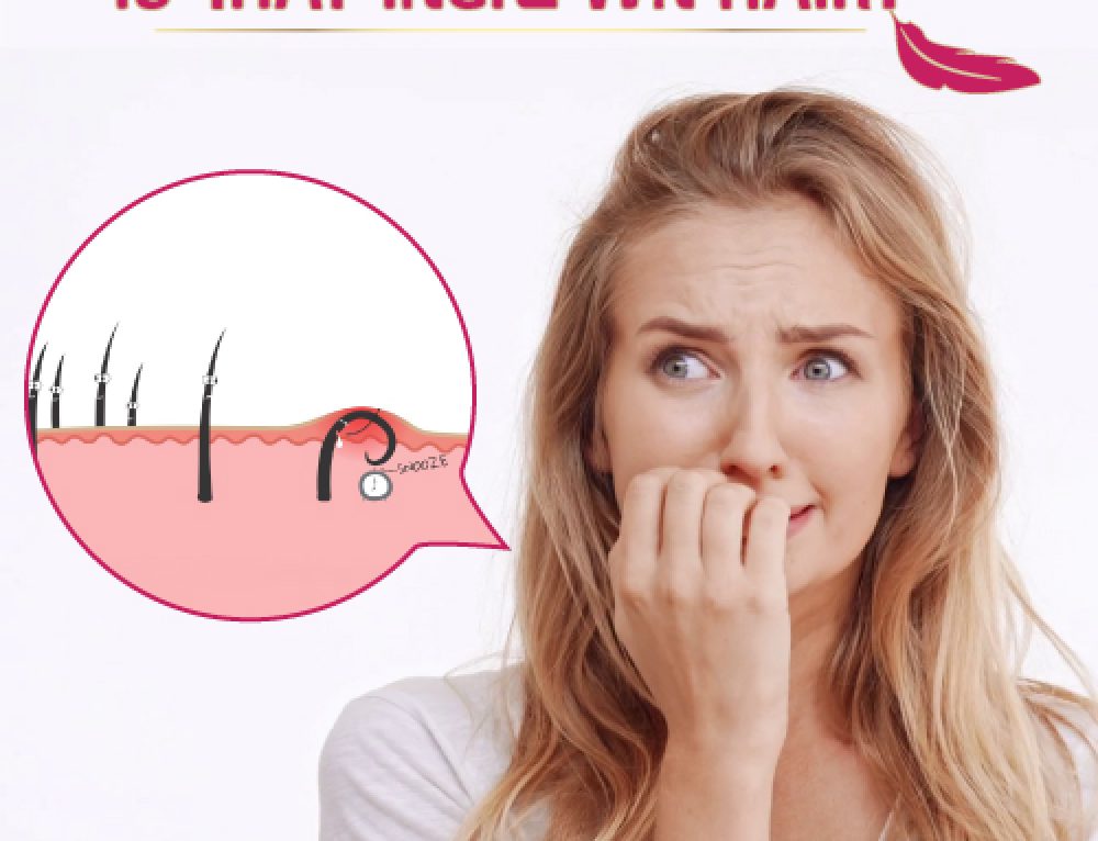 Ingrown Hair Don’t Care